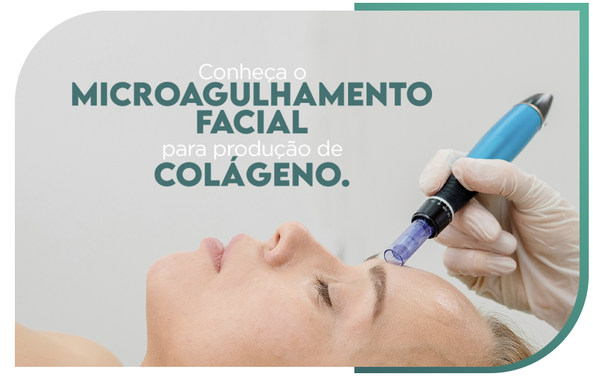 Conheça o microagulhamento facial para produção de colágeno